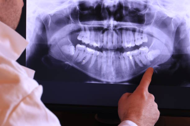 Best Dentist for Tooth Abscess  in , DC