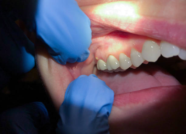 Best Emergency Gum Pain Relief  in , DC