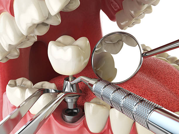 Best Urgent Tooth Repair  in , DC